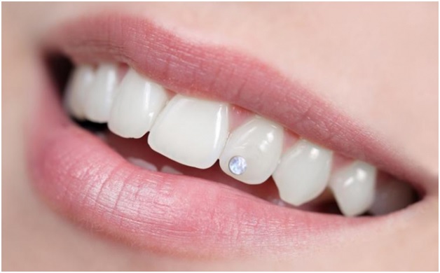 Stomatologie sector 5, dentist Bucuresti, Stomatologie Rahova, dentist sector 5, dentist Rahova, Albire dentară sector 5, Albire dentară Bucuresti, Albire dentară Rahova, Bijuterii dentare sector 5, Bijuterii dentare, Fațete dentare sector 5, Obturații dentare sector 5, Aparat dentar sector 5, Implant dentar sector 5, Stomatologie copii, Stomatologie copii sector 5, Stomatologie copii Rahova, dentist copii sector 5, dentist copii Rahova, dentist copii