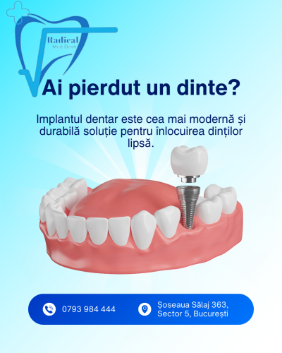 Stomatologie sector 5, dentist Bucuresti, Stomatologie Rahova, dentist sector 5, dentist Rahova, Albire dentară sector 5, Albire dentară Bucuresti, Albire dentară Rahova, Bijuterii dentare sector 5, Bijuterii dentare, Fațete dentare sector 5, Obturații dentare sector 5, Aparat dentar sector 5, Implant dentar sector 5, Stomatologie copii, Stomatologie copii sector 5, Stomatologie copii Rahova, dentist copii sector 5, dentist copii Rahova, dentist copii