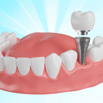 Stomatologie sector 5, dentist Bucuresti, Stomatologie Rahova, dentist sector 5, dentist Rahova, Albire dentară sector 5, Albire dentară Bucuresti, Albire dentară Rahova, Bijuterii dentare sector 5, Bijuterii dentare, Fațete dentare sector 5, Obturații dentare sector 5, Aparat dentar sector 5, Implant dentar sector 5, Stomatologie copii, Stomatologie copii sector 5, Stomatologie copii Rahova, dentist copii sector 5, dentist copii Rahova, dentist copii