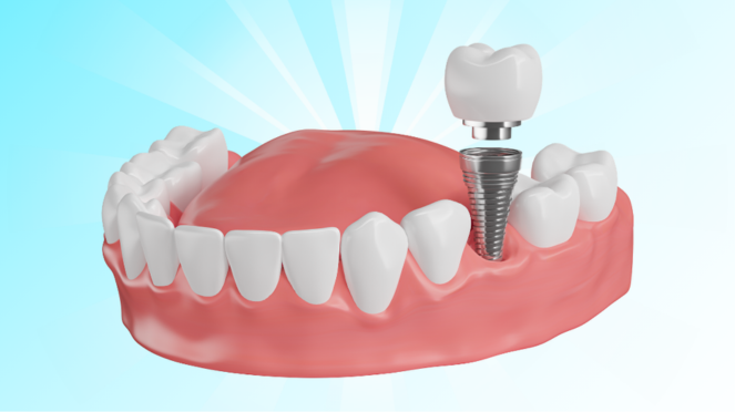 Stomatologie sector 5, dentist Bucuresti, Stomatologie Rahova, dentist sector 5, dentist Rahova, Albire dentară sector 5, Albire dentară Bucuresti, Albire dentară Rahova, Bijuterii dentare sector 5, Bijuterii dentare, Fațete dentare sector 5, Obturații dentare sector 5, Aparat dentar sector 5, Implant dentar sector 5, Stomatologie copii, Stomatologie copii sector 5, Stomatologie copii Rahova, dentist copii sector 5, dentist copii Rahova, dentist copii