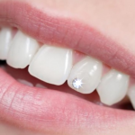 Stomatologie sector 5, dentist Bucuresti, Stomatologie Rahova, dentist sector 5, dentist Rahova, Albire dentară sector 5, Albire dentară Bucuresti, Albire dentară Rahova, Bijuterii dentare sector 5, Bijuterii dentare, Fațete dentare sector 5, Obturații dentare sector 5, Aparat dentar sector 5, Implant dentar sector 5, Stomatologie copii, Stomatologie copii sector 5, Stomatologie copii Rahova, dentist copii sector 5, dentist copii Rahova, dentist copii