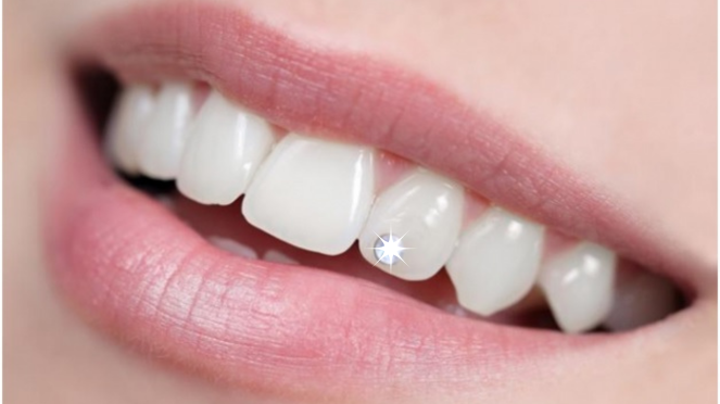 Stomatologie sector 5, dentist Bucuresti, Stomatologie Rahova, dentist sector 5, dentist Rahova, Albire dentară sector 5, Albire dentară Bucuresti, Albire dentară Rahova, Bijuterii dentare sector 5, Bijuterii dentare, Fațete dentare sector 5, Obturații dentare sector 5, Aparat dentar sector 5, Implant dentar sector 5, Stomatologie copii, Stomatologie copii sector 5, Stomatologie copii Rahova, dentist copii sector 5, dentist copii Rahova, dentist copii